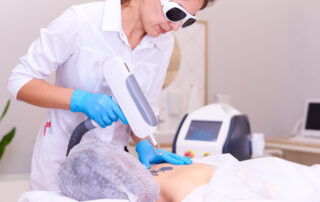 Laser tattoo removal services in Arcadia CA