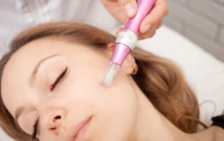 Mesotherapy in salon, cosmetologist, microneedles for rejuvenation and elimination of shortcomings.